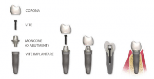 Componentistica Impianto 300x154